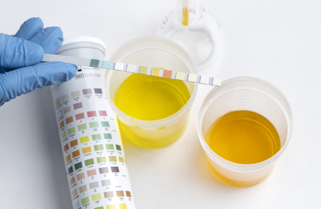 lab-doctor-performing-medical-exam-urine